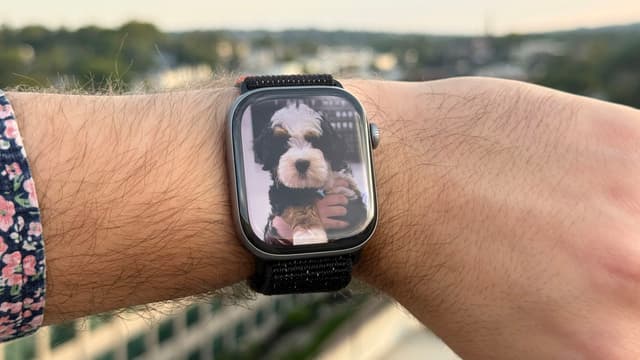 Apple Watch Series 11